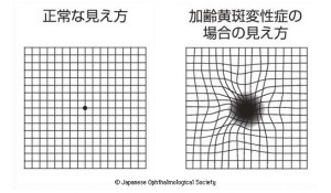 コラム小出(7)-図2